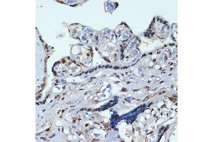 Immunohistochemistry of paraffin-embedded human placenta using HOX Rabbit mAb (ABIN7267764) at dilution of 1:100 (40x lens).
