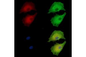 ABIN7095153 and ABIN7099209 staining  cells by IF/ICC.