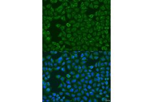 Immunofluorescence analysis of U2OS cells using FMO5 antibody (ABIN6133516, ABIN6140714, ABIN6140715 and ABIN6223596) at dilution of 1:100. (FMO5 Antikörper  (AA 1-285))