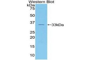 Western Blotting (WB) image for anti-Tubulin, beta 1 (TUBB1) (AA 182-437) antibody (ABIN3203927) (TUBB1 Antikörper  (AA 182-437))