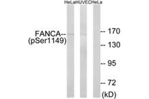 Western blot analysis of extracts from HeLa cells treated with IGF 100ng/ml 10' and HuvEc cells treated with EGF 200ng/ml 30', using FANCA (Phospho-Ser1149) Antibody. (FANCA Antikörper  (pSer1149))