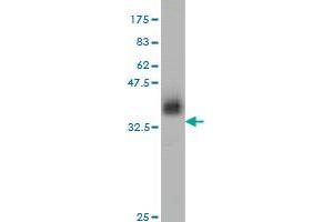 Western Blot detection against Immunogen (37. (ZNF41 Antikörper  (AA 221-321))