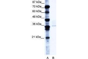 WB Suggested Anti-PCGF4 Antibody Titration:  0. (BMI1 Antikörper  (C-Term))