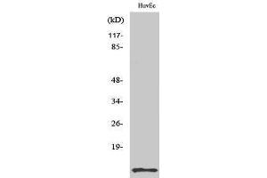 Western Blotting (WB) image for anti-Diazepam Binding Inhibitor (DBI) (Internal Region) antibody (ABIN3183140) (Diazepam Binding Inhibitor Antikörper  (Internal Region))