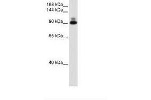 Image no. 2 for anti-Actinin, alpha 2 (ACTN2) (C-Term) antibody (ABIN204968) (ACTN2 Antikörper  (C-Term))