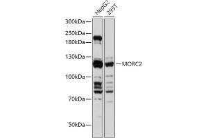 Western Blotting (WB) image for anti-MORC Family CW-Type Zinc Finger 2 (MORC2) (AA 60-250) antibody (ABIN7268683)