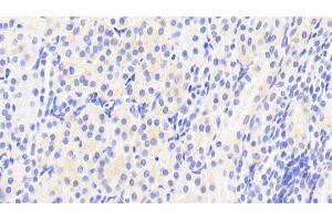 Detection of AFM in Human Kidney Tissue using Polyclonal Antibody to Afamin (AFM) (Afamin Antikörper  (AA 22-210))