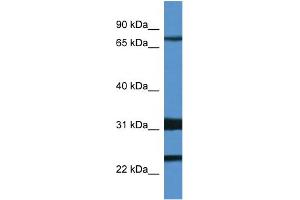 Western Blotting (WB) image for anti-Potassium Voltage-Gated Channel, Shal-Related Subfamily, Member 1 (Kcnd1) (N-Term) antibody (ABIN2776171)