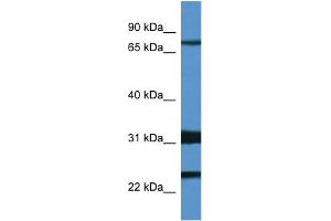 WB Suggested Anti-Kcnd1 Antibody   Titration: 1. (KCND1 Antikörper  (N-Term))