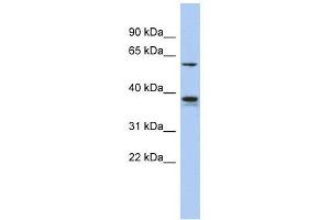 GOPC antibody used at 1 ug/ml to detect target protein. (GOPC Antikörper  (Middle Region))