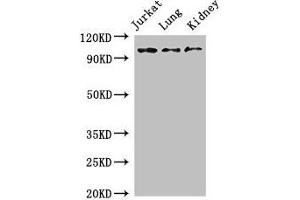 Western Blot Positive WB detected in: Jurkat whole cell lysate, Mouse lung tissue, Mouse kidney tissue All lanes: SMARCAL1 antibody at 3 μg/mL Secondary Goat polyclonal to rabbit IgG at 1/50000 dilution Predicted band size: 106 kDa Observed band size: 106 kDa (SMARCAL1 Antikörper  (AA 6-277))