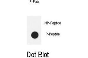 Dot blot analysis of anti-Phospho-IL6ST-Y905 Phospho-specific Pab on nitrocellulose membrane. (CD130/gp130 Antikörper  (pTyr905))