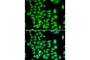 Immunofluorescence analysis of A549 cell using TREX1 antibody.