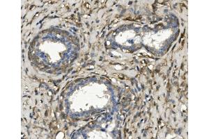 IHC analysis of non-muscle Myosin IIB/MYH10 using anti-non-muscle Myosin IIB/MYH10 antibody (ABIN7603186). (MYH10 Antikörper  (N-Term))