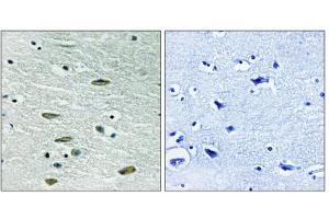 Immunohistochemistry (IHC) image for anti-Insulin-Like Growth Factor 1 Receptor (IGF1R) (Tyr1346) antibody (ABIN1848190)