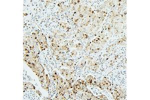 IHC analysis of MCM2 using anti-MCM2 antibody (ABIN7601593).