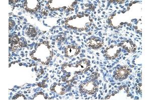 Ankyrin 1 antibody was used for immunohistochemistry at a concentration of 4-8 ug/ml to stain Alveolar cells (arrows) in Human Lung. (Erythrocyte Ankyrin Antikörper  (C-Term))