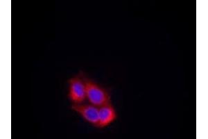 Image no. 1 for anti-VEGF Receptor 2 (VEGFR2) (AA 949-953) antibody (ABIN197240) (VEGFR2/CD309 Antikörper  (AA 949-953))