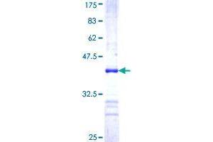 Image no. 1 for RPTOR Independent Companion of mTOR, Complex 2 (RICTOR) (AA 1-98) protein (GST tag) (ABIN1318068) (RICTOR Protein (AA 1-98) (GST tag))