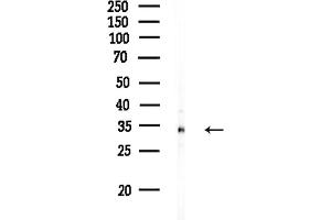 Western blot analysis of lysates from Rat liver, using CDC123 Antibody at 1/1000 dilution.