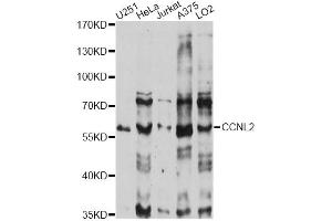 Western blot analysis of extracts of various cell lines, using CCNL2 antibody (ABIN6290271) at 1:1000 dilution. (Cyclin L2 Antikörper)