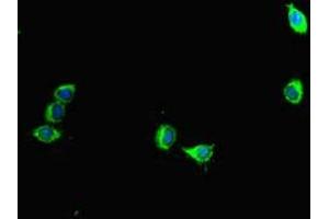 Immunofluorescent analysis of Hela cells using ABIN7145075 at dilution of 1:100 and Alexa Fluor 488-congugated AffiniPure Goat Anti-Rabbit IgG(H+L) (Aurora A Antikörper  (AA 1-131))