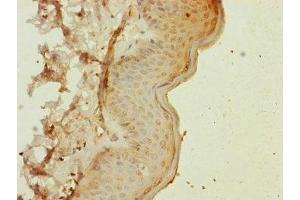 Immunohistochemistry of paraffin-embedded human skin tissue using ABIN7160531 at dilution of 1:100 (MYL1 Antikörper  (AA 1-150))