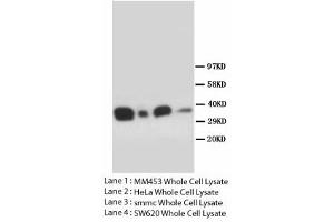 Image no. 1 for anti-Forkhead Box L2 (FOXL2) (N-Term) antibody (ABIN1495192) (FOXL2 Antikörper  (N-Term))