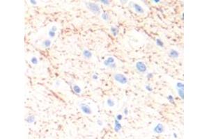 IHC-P analysis of Human Tissue, with DAB staining. (SLC6A3 Antikörper  (AA 562-620))