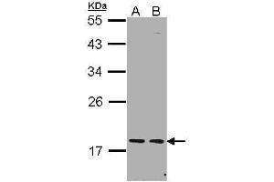 WB Image Sample (30 ug of whole cell lysate) A: H1299 B: Hela 12% SDS PAGE antibody diluted at 1:1000 (PCNP Antikörper  (N-Term))