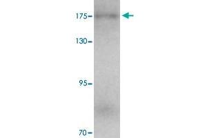 Western blot analysis of KIAA0196 in human ovary tissue with KIAA0196 polyclonal antibody  at 1 ug/mL. (Strumpellin Antikörper  (C-Term))