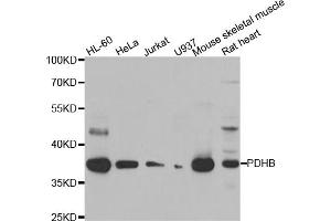 Western blot analysis of extracts of various cell lines, using PDHB antibody (ABIN5975451) at 1/1000 dilution. (PDHB Antikörper)