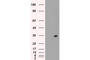 Image no. 2 for anti-Fc gamma RII (CD32) antibody (ABIN1497255) (Fc gamma RII (CD32) Antikörper)