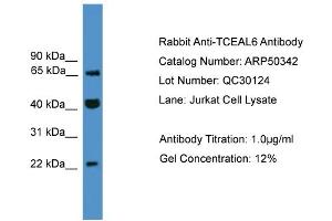 WB Suggested Anti-TCEAL6  Antibody Titration: 0.