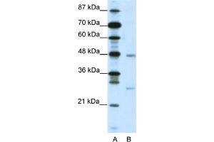 WB Suggested Anti-MXD4 Antibody   Titration: 2. (MXD4 Antikörper  (N-Term))