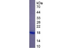SDS-PAGE of Protein Standard from the Kit (Highly purified E. (RPN1 ELISA Kit)