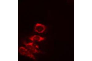 ABIN6274823 staining COLO205 cells by IF/ICC. (AKR1A1 Antikörper  (C-Term))