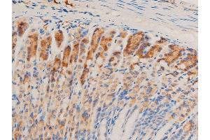ABIN6267067 at 1/100 staining mouse gastric tissue sections by IHC-P. (TGFB1 Antikörper  (C-Term))