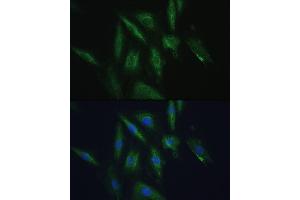 Immunofluorescence analysis of H9C2 cells using SRPRB antibody (ABIN6132685, ABIN6148459, ABIN6148460 and ABIN6214895) at dilution of 1:100.