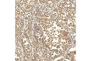 IHC analysis of Citrin/SLC25A13 using anti-Citrin/SLC25A13 antibody (ABIN7599512). (slc25a13 Antikörper  (AA 1-643))