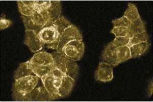 Immunofluorescence staining of A431 cells. (RABEP1 Antikörper  (AA 247-417))