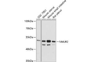 Western blot analysis of extracts of various cell lines, using NMUR2 antibody (ABIN6128345, ABIN6144693, ABIN6144694 and ABIN6216572) at 1:3000 dilution. (NMUR2 Antikörper  (AA 326-415))