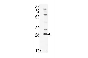 Western blot analysis of TSSK4 using rabbit polyclonal TSSK4 Antibody using 293 cell lysates (2 ug/lane) either nontransfected (Lane 1) or transiently transfected (Lane 2) with the TSSK4 gene. (TSSK4 Antikörper  (C-Term))