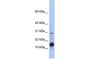 HIST2H2BF antibody used at 1 ug/ml to detect target protein.