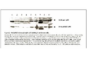 Image no. 2 for anti-Nuclear Factor-kB p65 (NFkBP65) (pSer529) antibody (ABIN116929) (NF-kB p65 Antikörper  (pSer529))