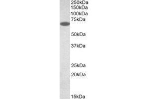 Western Blotting (WB) image for anti-Protein Disulfide Isomerase Family A, Member 2 (PDIA2) (AA 477-489) antibody (ABIN1491836) (PDIA2 Antikörper  (AA 477-489))