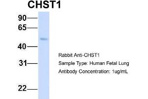 Host: Rabbit Target Name: CHST1 Sample Type: Human Fetal Lung Antibody Dilution: 1. (CHST1 Antikörper  (Middle Region))