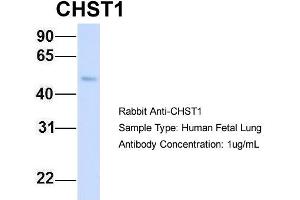 Host: Rabbit Target Name: CHST1 Sample Type: Human Fetal Lung Antibody Dilution: 1.