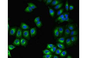 Immunofluorescent analysis of A549 cells using ABIN7164501 at dilution of 1:100 and Alexa Fluor 488-congugated AffiniPure Goat Anti-Rabbit IgG(H+L) (GPR75 Antikörper  (AA 372-540))