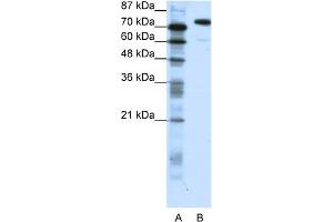 WB Suggested Anti-SATB1 Antibody Titration:  1. (SATB1 Antikörper  (C-Term))